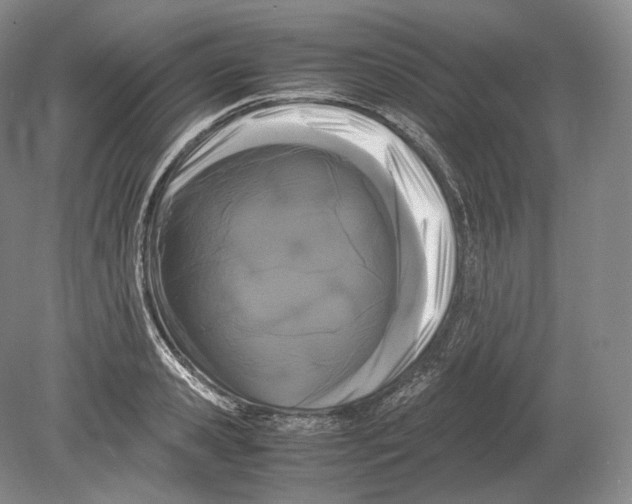 X0000078860941200612111644