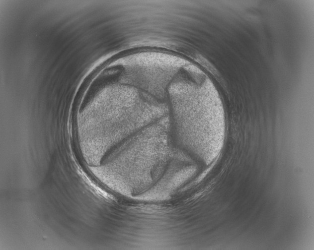 X0000078861028200612111642