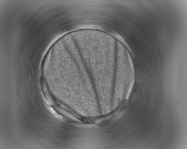 X0000078861140200612111641