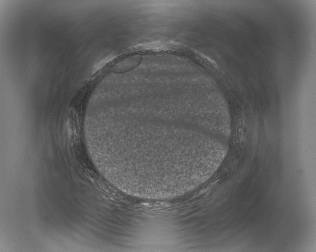 X0000078861158200612111640