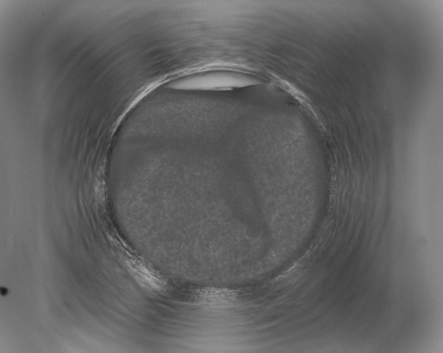 X0000078861170200612111640