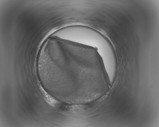 X0000078861181200612111640