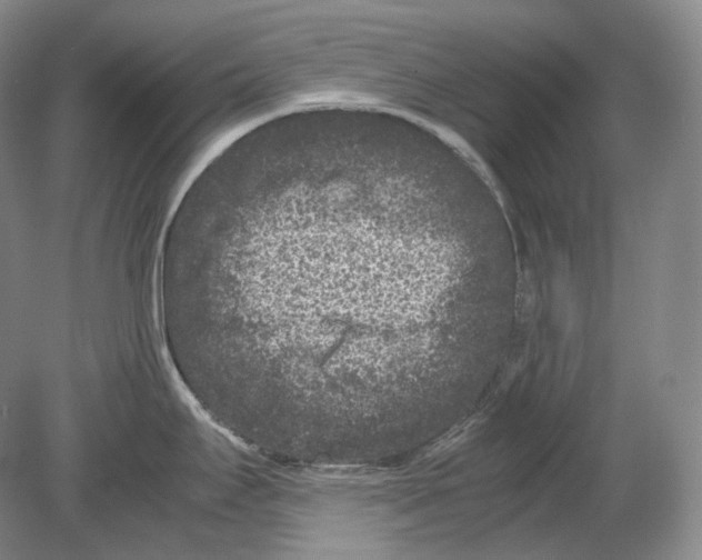 X0000078861295200612111638