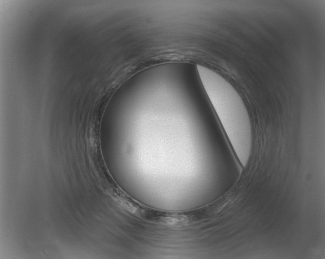 X0000078870317200611131035