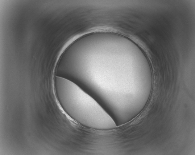 X0000078871440200611131017