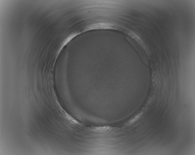 X0000078871081200611131211