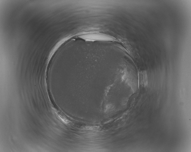 X0000078870147200611271310