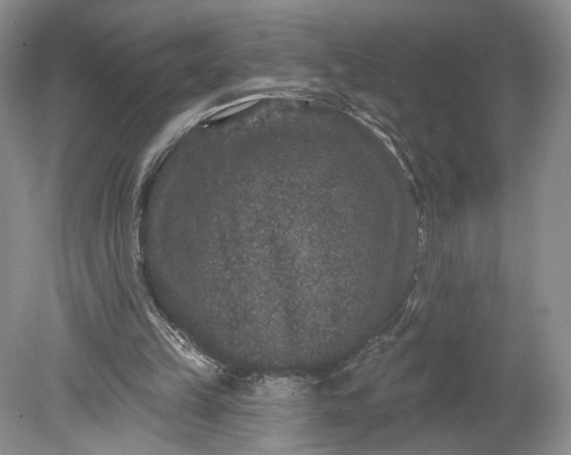 X0000078870149200611271310