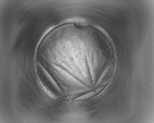 X0000078871248200611271253