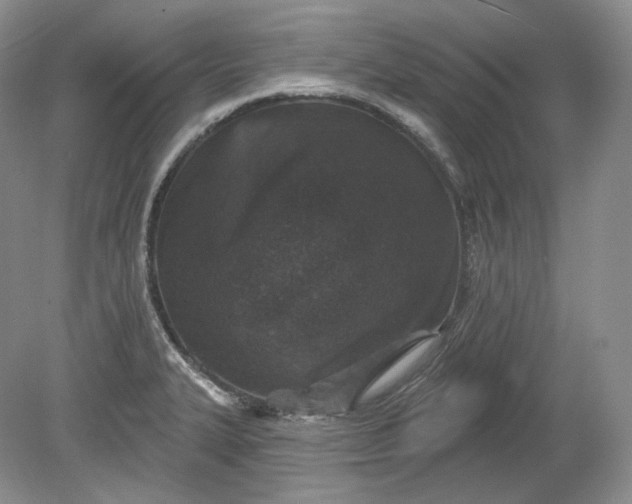 X0000078871327200611271251