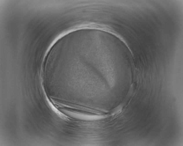 X0000078871531200611271248