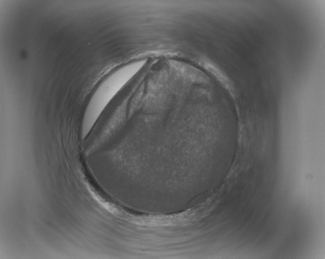 X0000078870009200612042010