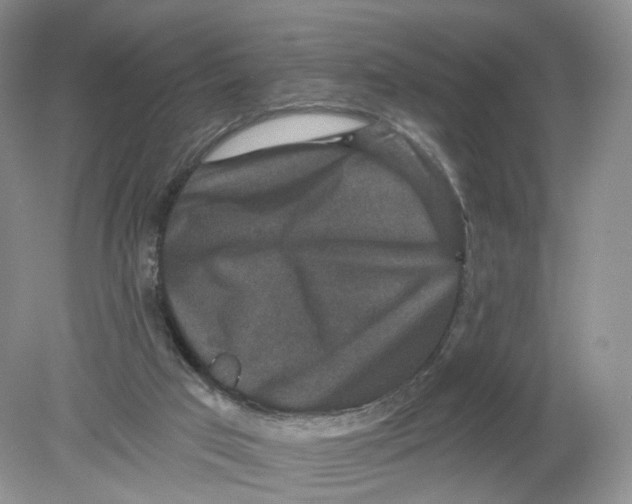 X0000078870017200612042010