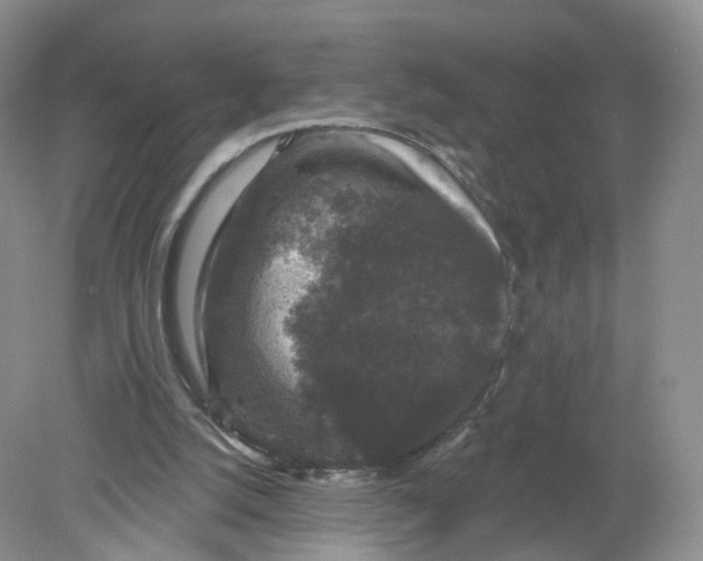 X0000078870056200612042009