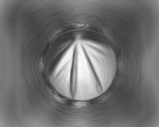 X0000078870085200612042009