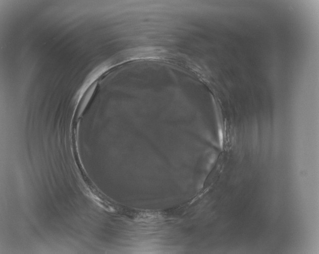 X0000078870099200612042008