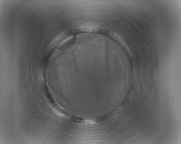 X0000078870114200612042008