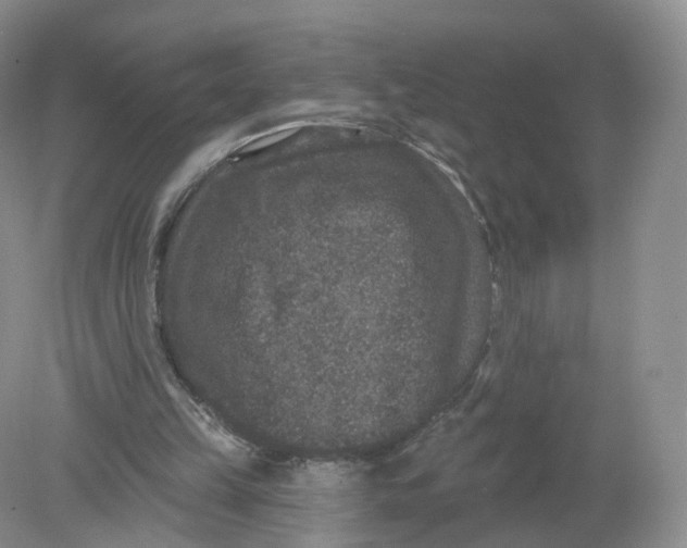 X0000078870149200612042007