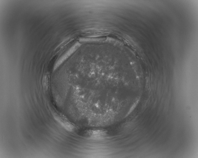 X0000078870165200612042007