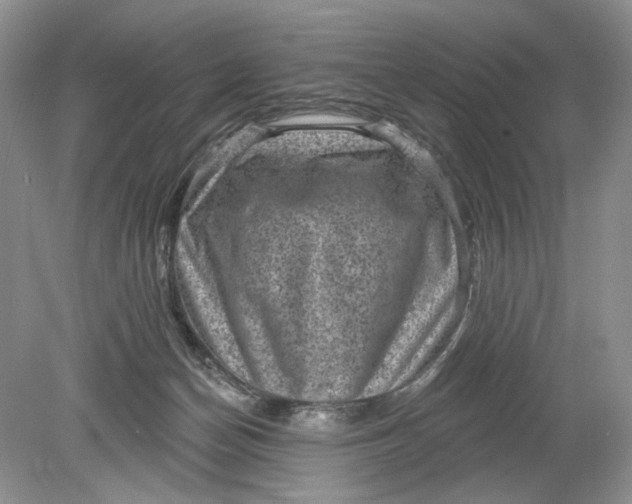 X0000078870174200612042007