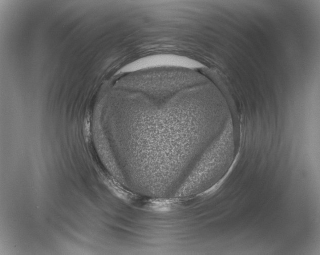 X0000078870190200612042008