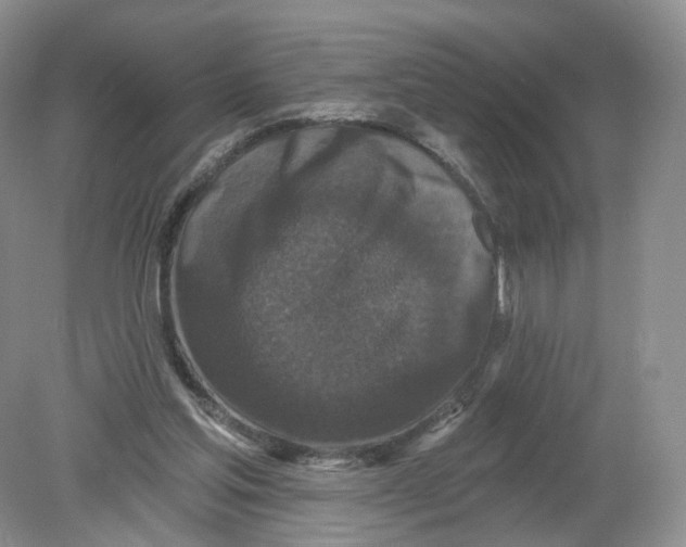 X0000078870205200612042007