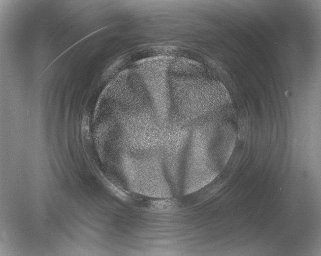 X0000078870238200612042006