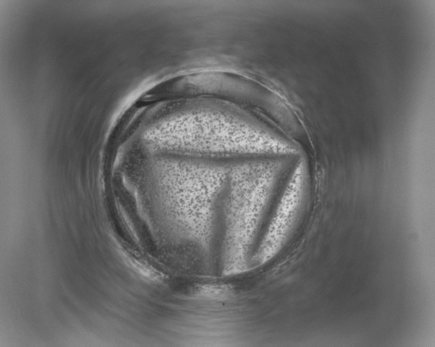 X0000078870248200612042005