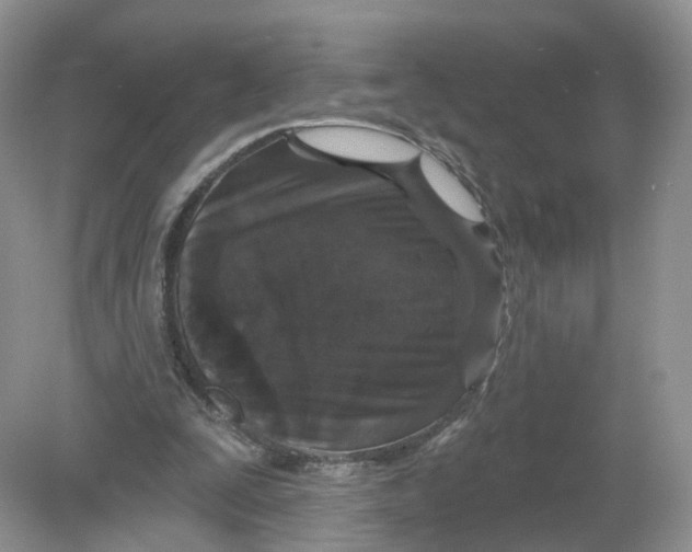 X0000078870295200612042005