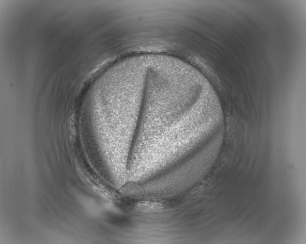 X0000078870354200612042004