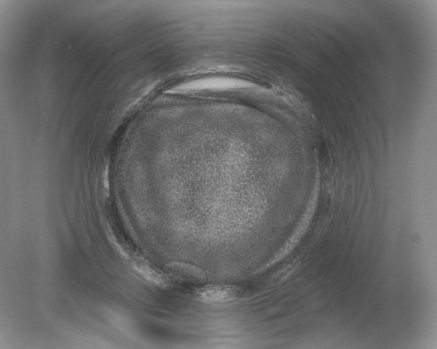 X0000078870358200612042004