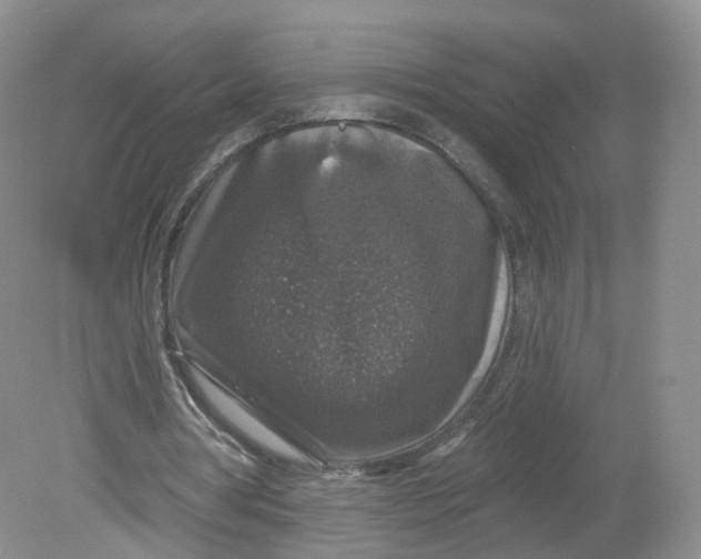 X0000078870386200612042004