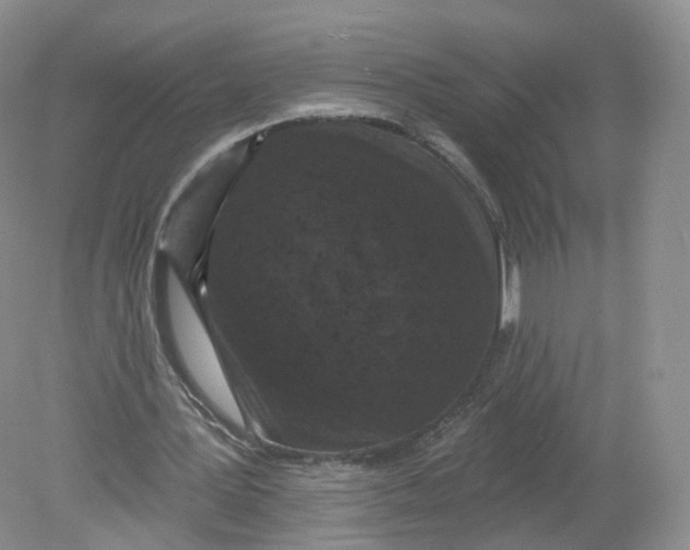 X0000078870387200612042004