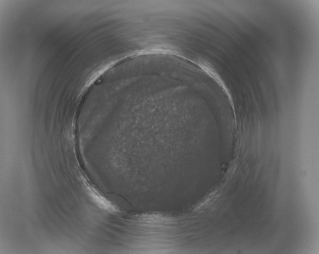 X0000078870389200612042003