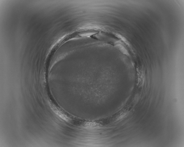 X0000078870399200612042003