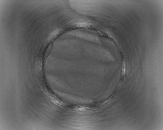 X0000078870407200612042003