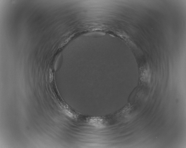 X0000078870471200612042003