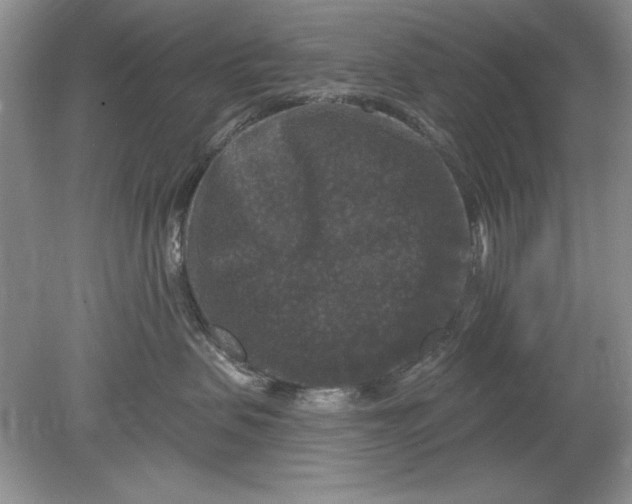 X0000078870479200612042003