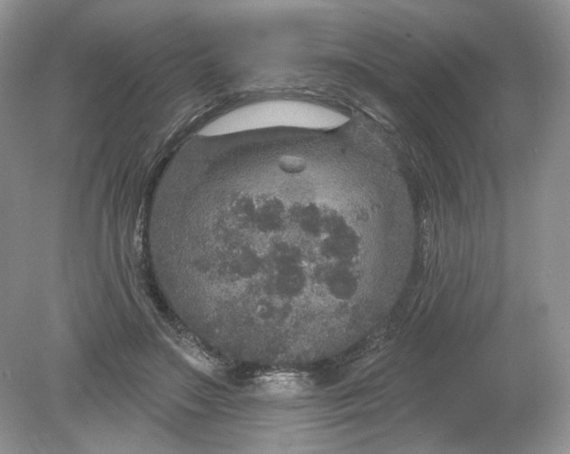 X0000078870499200612042002