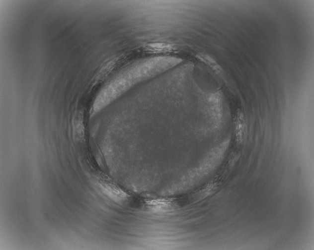 X0000078870516200612042001