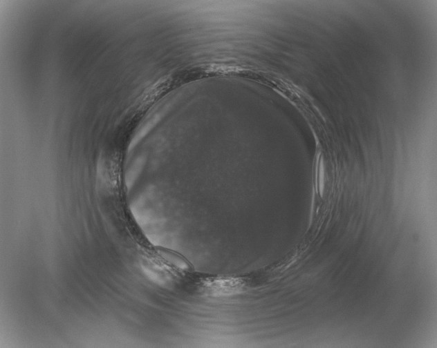 X0000078870517200612042001