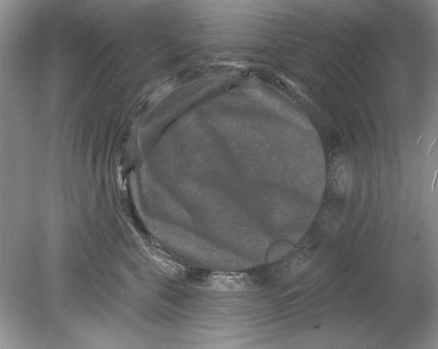 X0000078870571200612042001