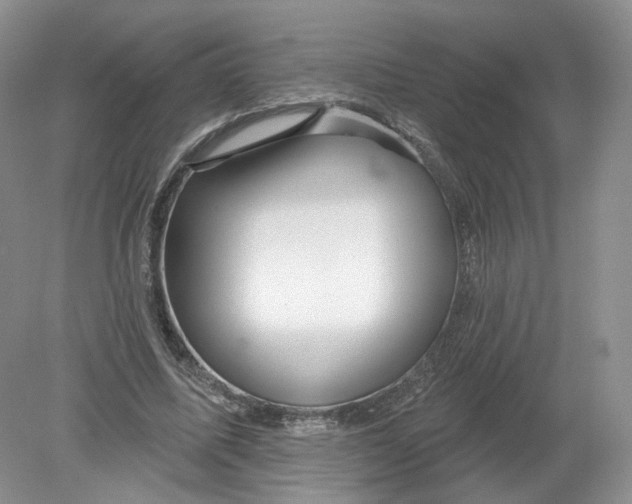 X0000078870587200612042000