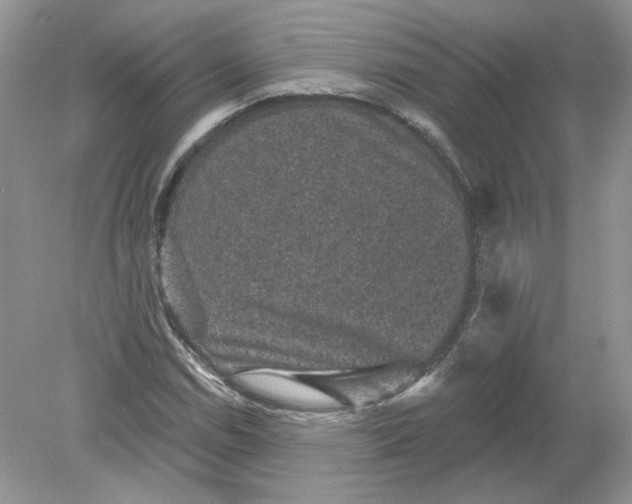 X0000078871114200612041951