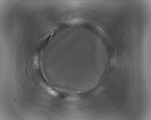 X0000078871156200612041951