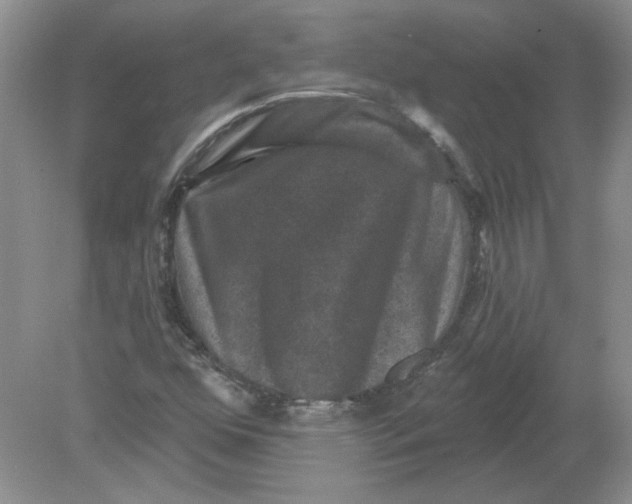 X0000078871352200612041947