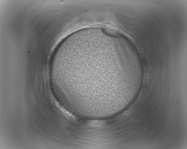 X0000078871506200612041944