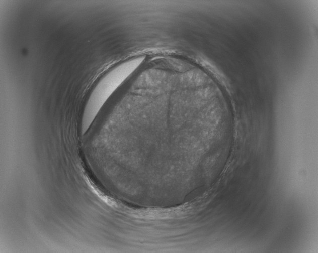 X0000078870009200612111725