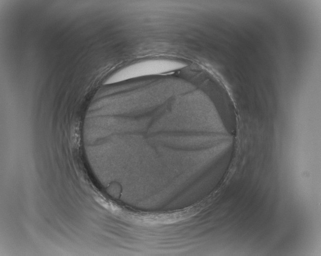 X0000078870017200612111725