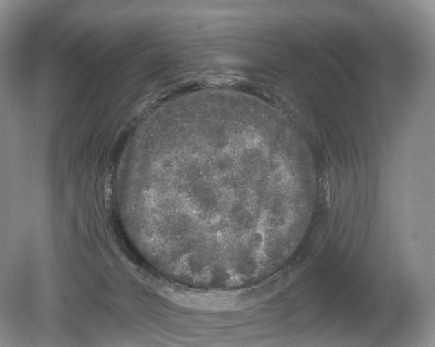 X0000078870032200612111725